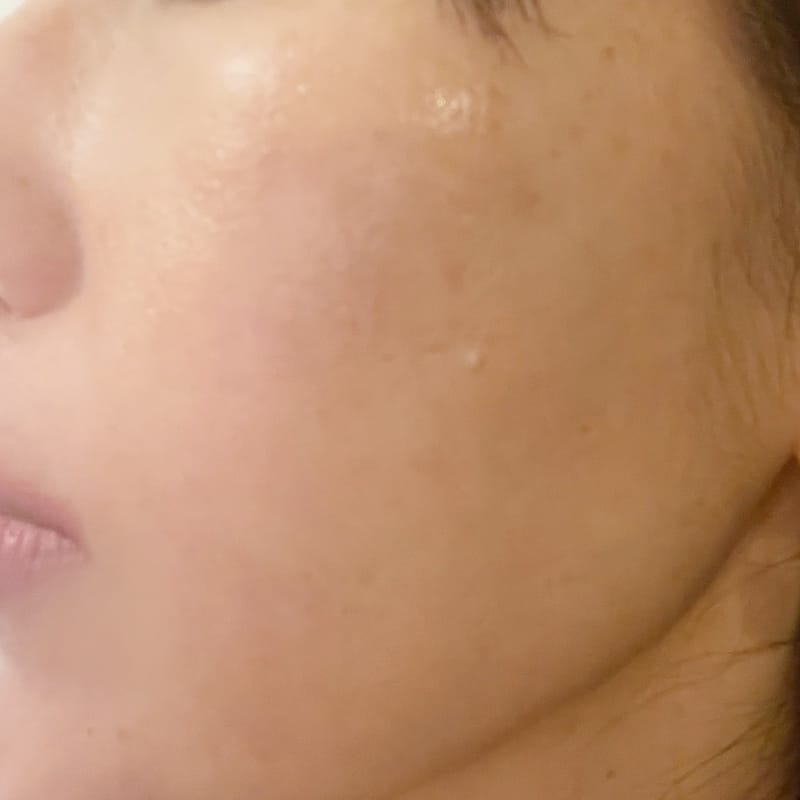 レベル3使用時の肌状態